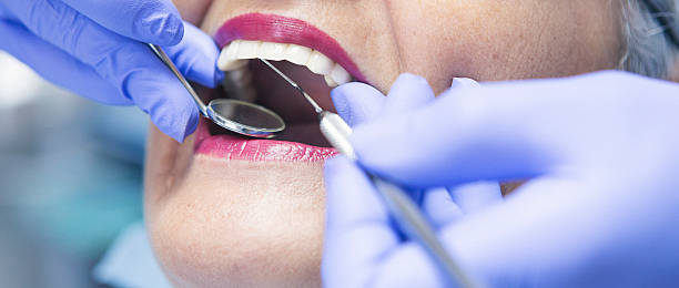 Best Emergency Treatment for Toothache in Hillsbo, OR